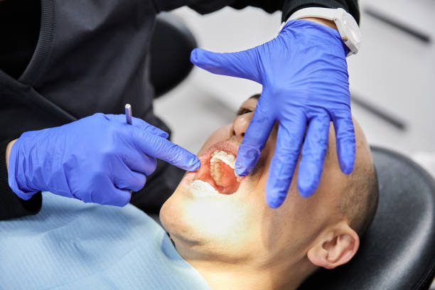 Best Emergency Dental Care for Abscessed Tooth in Warm Mineral Springs, FL
